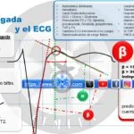 ECG Brugada Descargable